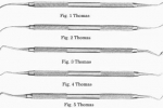 Thomas fig. 5