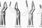 Kleszcze ekstrakcyjne fig. 51